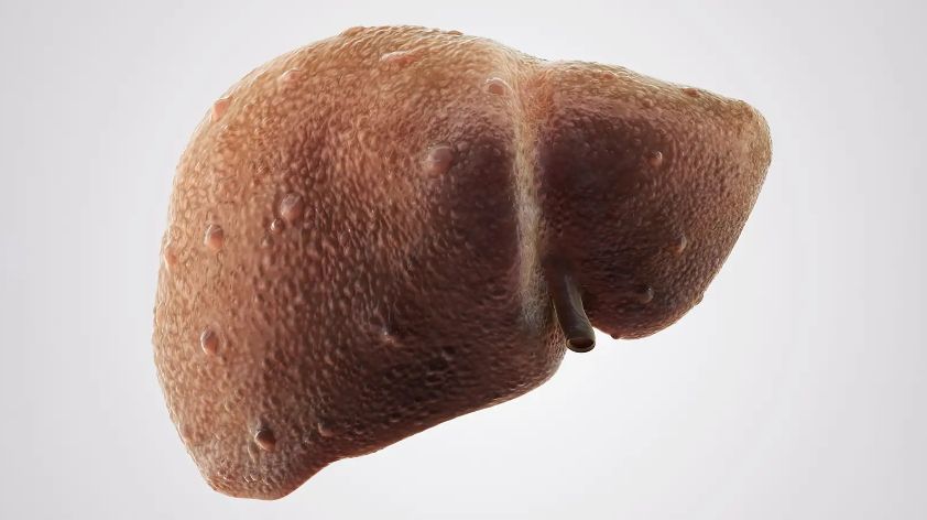 ������ ������: ���� � ��������� � ����� ����������� ��� �����������